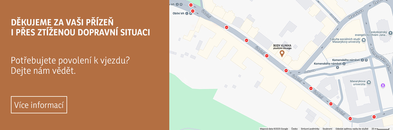 Banner k akci: Rekonstrukce Údolní