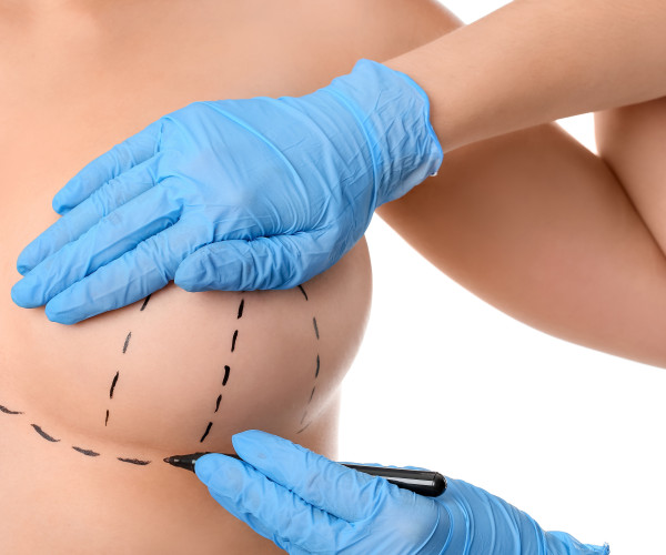 Plastická operace prsou na splátky Brno