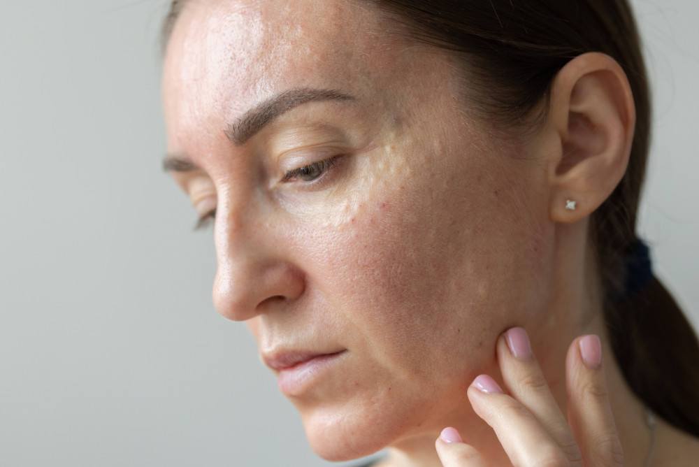 obličej z profilu po aplikaci lososí DNA