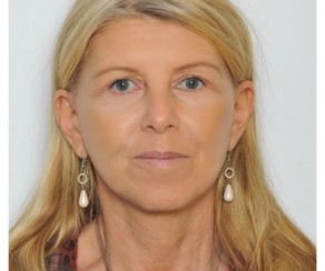 Foto po zákroku: Facelifting obličeje - projekt Proměna, Health and Beauty  (foto 17)