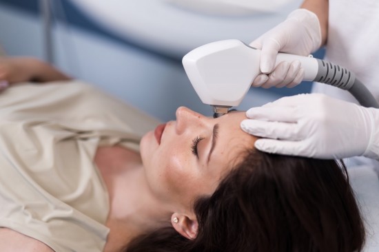 frakcni-D'diodovy-laser-3D-IPL